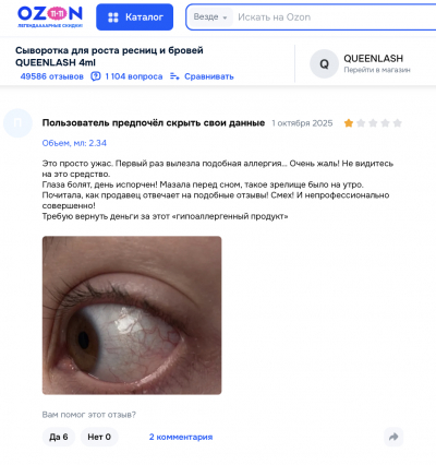 Queenlash отзывы: стоит ли доверять популярной сыворотке для роста ресниц?